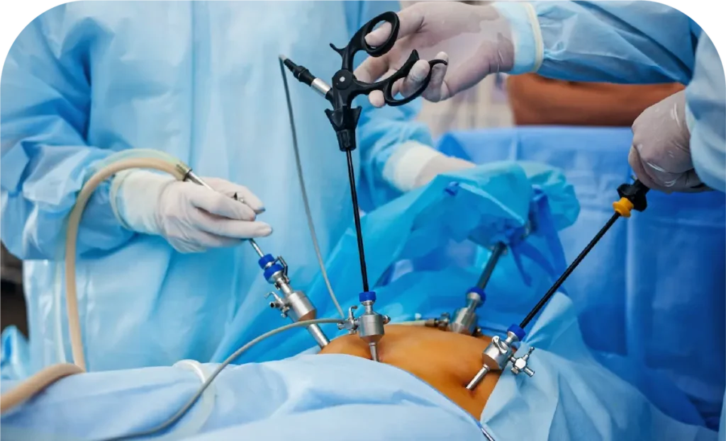 Urología Laparoscópica